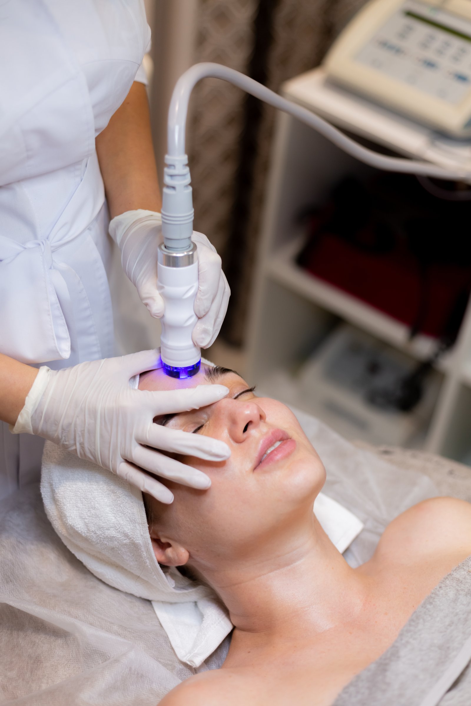 Professional chemical peel treatment in Madurai at Hues Aesthetic Clinic