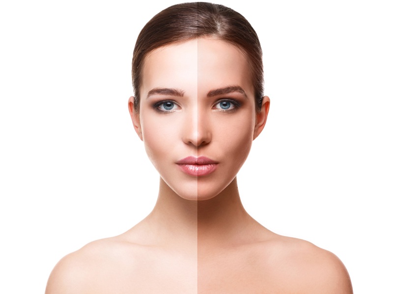 Hair Transplant in Madurai, hair clinic in Madurai, Skin Care in Madurai, Laser Treatment in Madurai, Hair Care in Madurai, hydra facial in Madurai, Hair Transplant near me, hair clinic near me, Skin Care near me, Hair Transplant in Madurai, best hair clinic in Madurai, best hydra facial in Madurai,  best hair transplantation clinic in madurai, best laser unwanted hair removal in Madurai, Best Hair Restoration in Madurai, Best Hair Replacement in Madurai, Best Hair Transplant Surgery in Madurai, Best Hair Loss Treatment in Madurai, Best Hair Grafting in Madurai, Best Hair Regrowth in Madurai, Best Hair Loss Solutions in Madurai, Best Hair Transplant Clinics in Madurai, Best Baldness Treatment in Madurai, Best Hair Transplant Recovery in Madurai, Best Hair Transplant Cost in Madurai, Best Hairline Restoration in Madurai, Best Scalp Treatments in Madurai, Best Hair Thinning Solutions in Madurai, Best skin clinic in madurai, Best laser treatment in madurai, best acne scar treatment in madurai, Best chemical peels in madurai , Best laser tattoo removal clinic in madurai , Best hair fall treatment clinic in madurai , best laser skin rejuvenation clinic in madurai , Best laser scar reduction clinic in madurai, best skin brightening treatment in Madurai, Best Hair Regrowth in Madurai, Best Hair Loss Solutions in Madurai, Best Hair Transplant Clinics in Madurai, Best Baldness Treatment in Madurai, Best Hair Transplant Recovery in Madurai, Best Hair Transplant Cost in Madurai, Best Hairline Restoration in Madurai, Best Scalp Treatments in Madurai, Best Hair Thinning Solutions in Madurai, Best Hair Transplant Before and After in Madurai, Best Hair Transplant Consultation in Madurai, Laser Hair Removal in Madurai, Laser Skin Therapy in Madurai, Laser Skin Resurfacing in Madurai, Best Follicular Unit Transplantation (FUT) in Madurai, Best Follicular Unit Extraction (FUE) in Madurai, Best Scalp Micropigmentation in Madurai, Best  Dark Circle Solutions in Madurai, Black Eye Treatment  in Madurai, Best Beauty Therapist in Madurai, Color-Centric Skincare in Madurai, Hue-Based Skin Treatment in Madurai, Skincare for All Hues in Madurai, Skin Care for Diverse Hues in Madurai, Skin Tone-Specific Treatments in Madurai, Skincare Solutions for Every Hue in Madurai, Hue-Specific Dermatology in Madurai, Skincare by Skin Tone in Madurai, Tailored Skin Treatment for Hues in Madurai, Personalized Skincare by Hues in Madurai, Skin Care for Various Hues in Madurai, Color-Based Skin Care in Madurai, Skin Health for All Tones in Madurai, Laser Skin Tightening in Madurai, Laser Wrinkle Reduction in Madurai, Laser Scar Removal in Madurai, Laser Pigmentation Treatment in Madurai, Laser Acne Treatment in Madurai, Laser Skin Rejuvenation in Madurai, Laser Tattoo Removal in Madurai, Non-Invasive Laser Treatment in Madurai, Laser Skin Care in Madurai, Medical Laser Treatment in Madurai, Laser Dermatology in Madurai, Advanced Laser Therapy in Madurai, Cosmetic Laser Procedures in Madurai, Laser Anti-Aging in Madurai, Fractional Laser Treatment in Madurai, Laser Treatment Recovery in Madurai, Hair Treatment in Madurai, Hair Restoration in Madurai, Hair Health in Madurai, Hair Growth in Madurai, Hair Repair in Madurai, Hair Loss Prevention in Madurai, Hair Conditioning in Madurai, Hair Strengthening in Madurai, Scalp Treatment in Madurai, Hair Moisturization in Madurai, Split Ends Repair in Madurai, Natural Hair Treatments in Madurai, Hair Coloring in Madurai, Heat Damage Repair in Madurai, Hair Masks in Madurai, Organic Hair Care in Madurai, Hair Shine in Madurai, Frizz Control in Madurai, Hair Serums in Madurai.