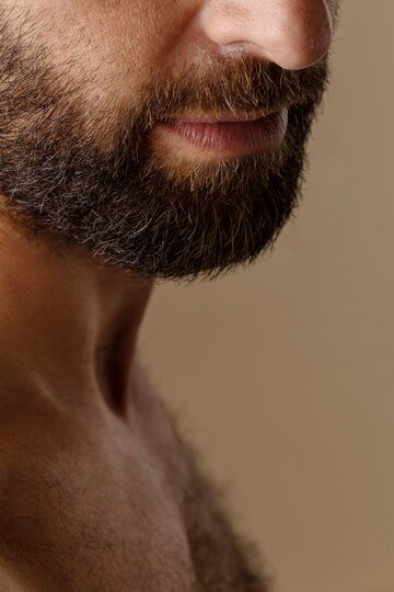 FUE beard transplant procedure in progress at Hues Aesthetic Clinic Madurai