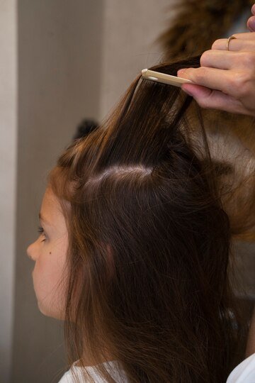 Specialist performing scientific anti-dandruff scalp treatment at Hues Aesthetic Clinic Madurai