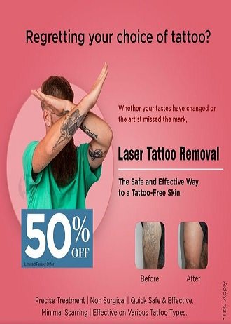 Specialist performing Q-switch laser tattoo removal at Hues Aesthetic Clinic Madurai