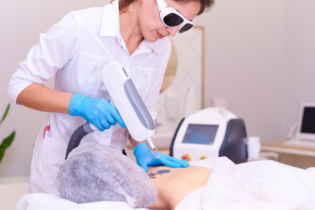 Specialist performing Q-switch laser tattoo removal at Hues Aesthetic Clinic Madurai