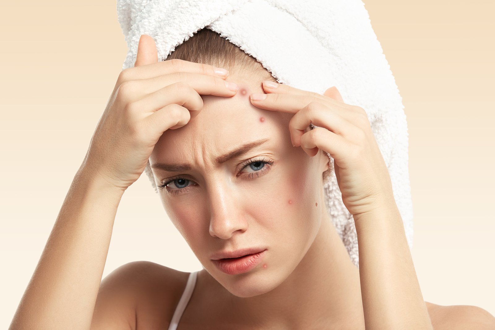 Skin care consultation for personalized acne treatment in Madurai