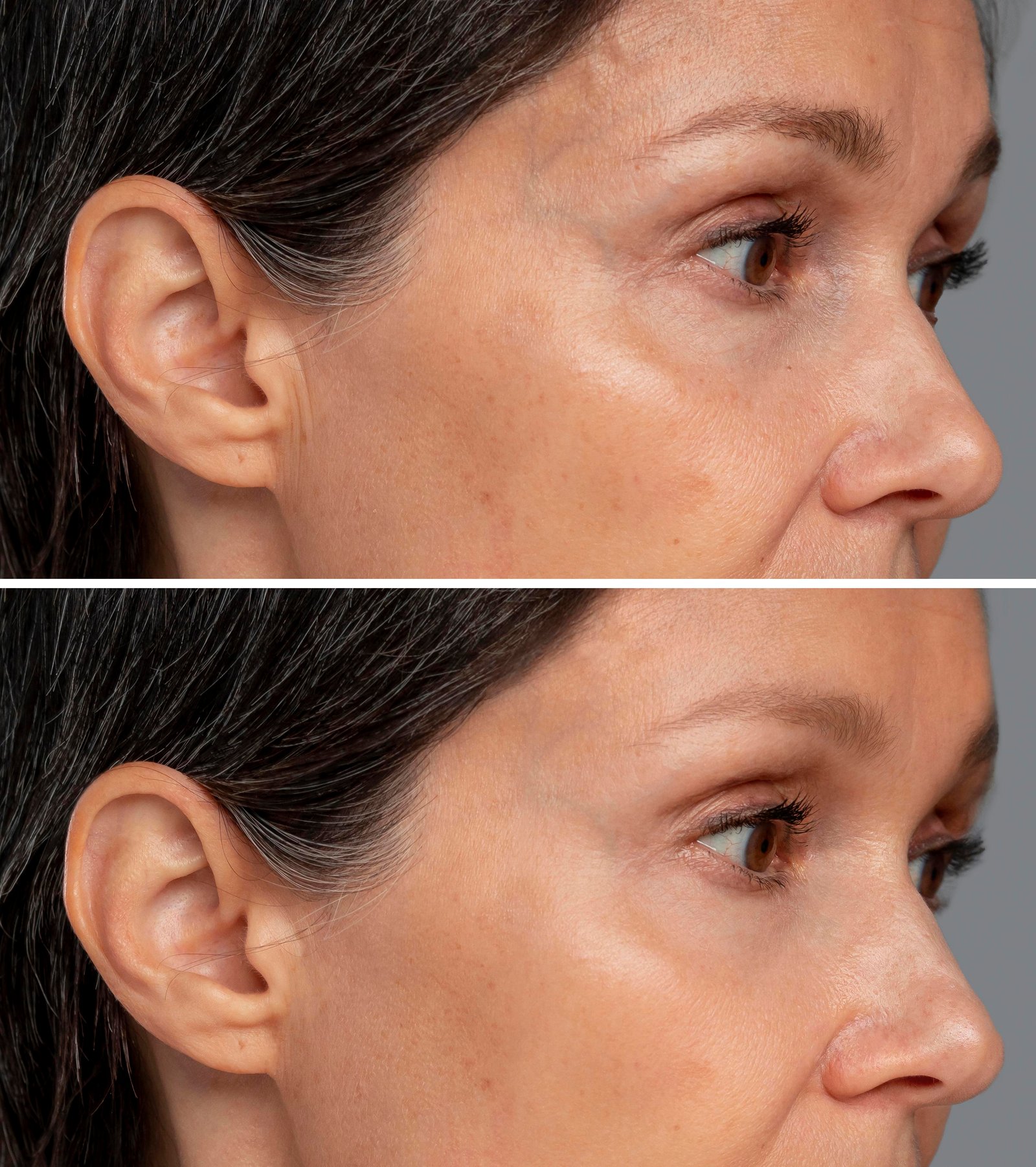 Dermatologist performing advanced anti aging skin treatment in Madurai