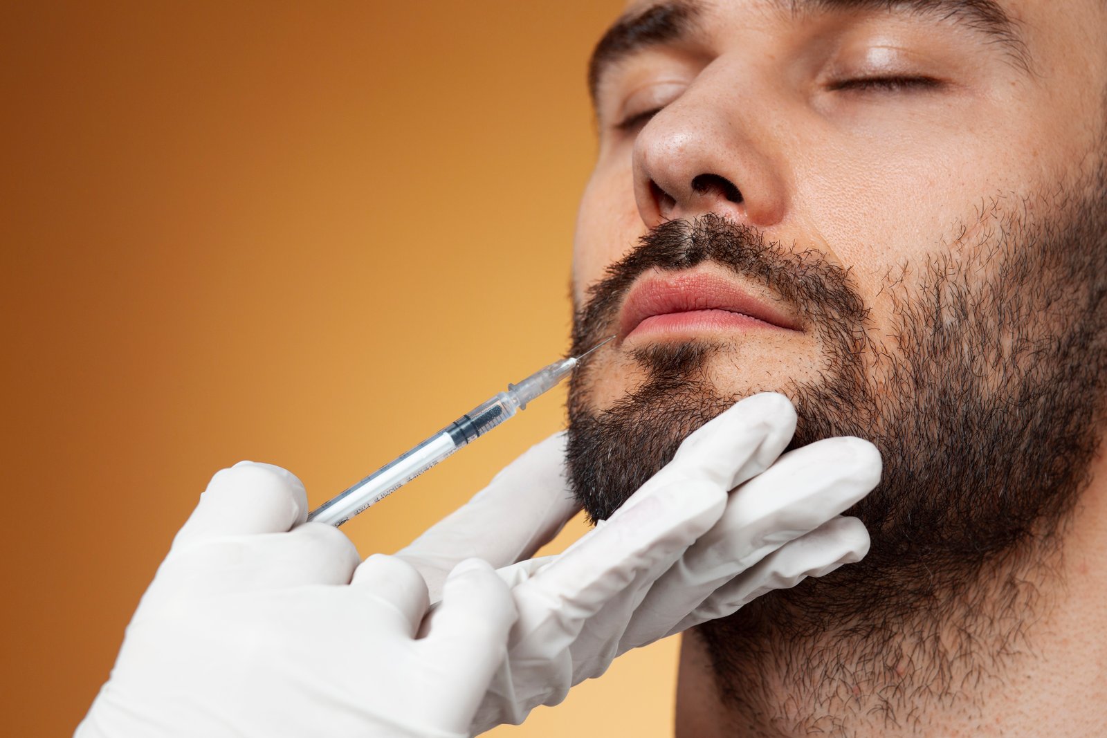 Beard PRP treatment before and after result at Hues Aesthetic Clinic, Madurai