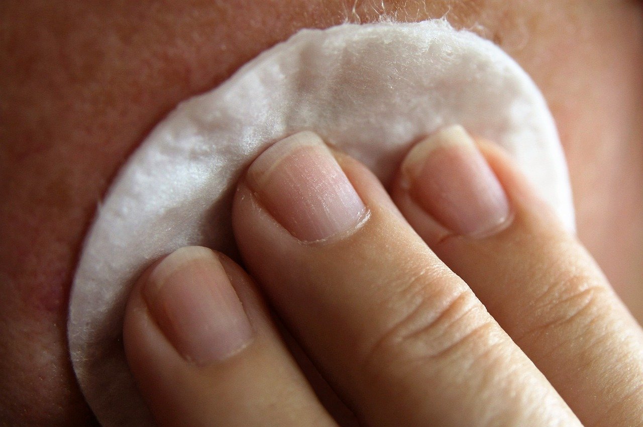 Professional chemical peel treatment in Madurai at Hues Aesthetic Clinic