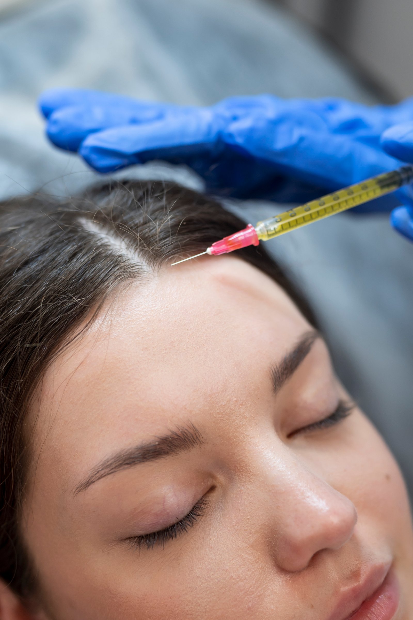 Specialist performing advanced laser hair reduction procedure at Hues Aesthetic Clinic Madurai