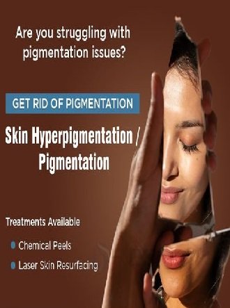 Specialist applying advanced Cosmelan peel for dark spot and pigmentation treatment at Hues Aesthetic Clinic Madurai