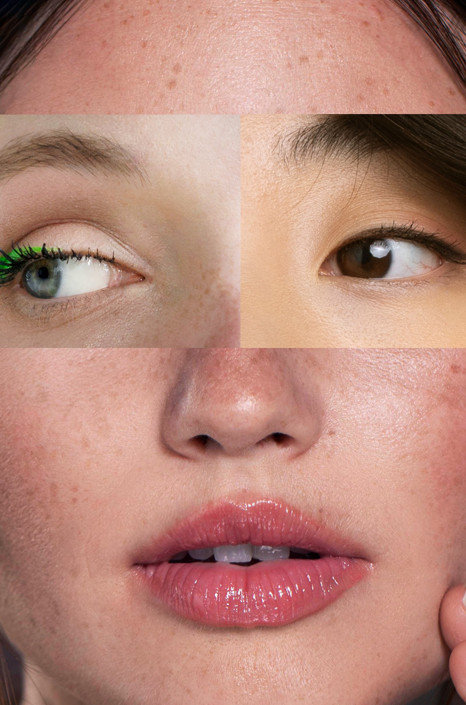 Specialist applying advanced Cosmelan peel for dark spot and pigmentation treatment at Hues Aesthetic Clinic Madurai
