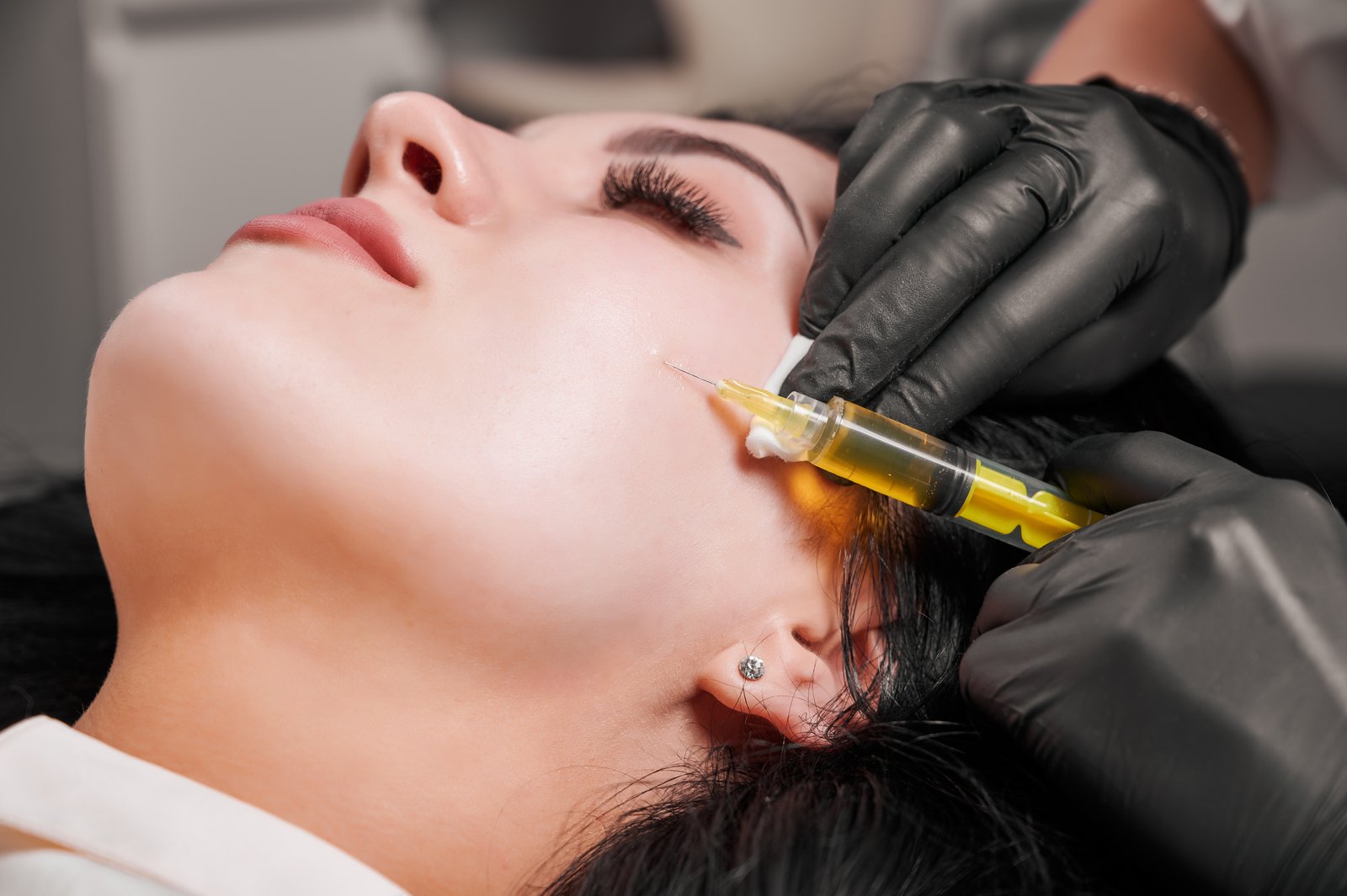 Specialist performing natural Skin PRP treatment at Hues Aesthetic Clinic Madurai